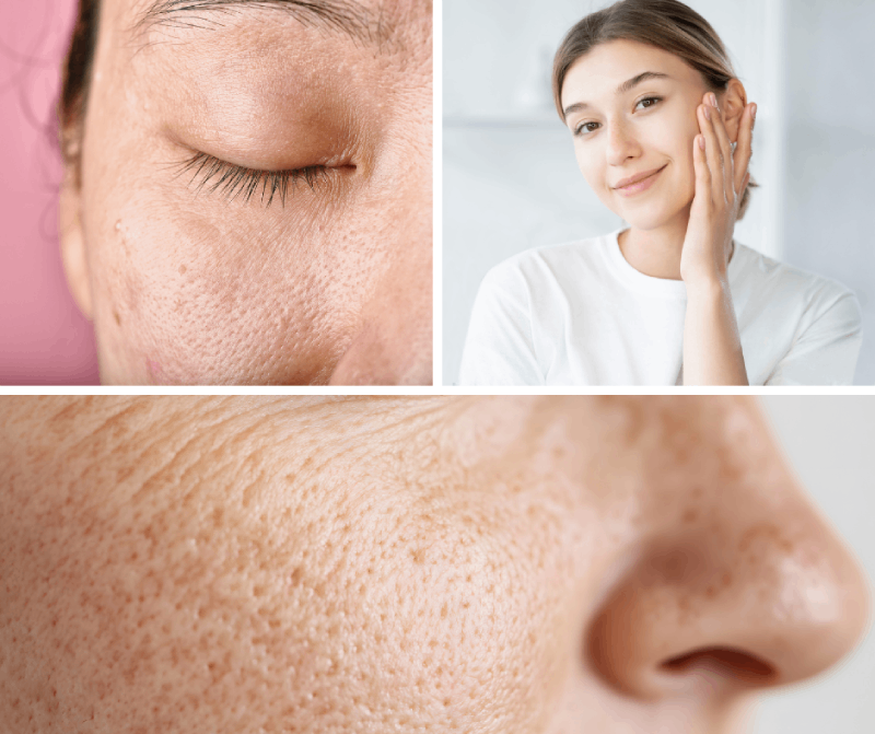 Pro koho je vhodný fluid Éclat de Rose